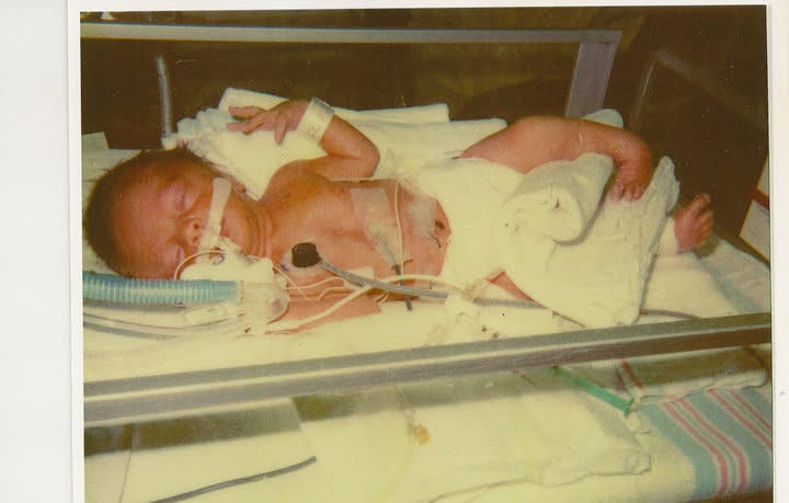 NICU photo